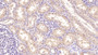 DAB staining on IHC-P; Samples: Human Kidney Tissue; Primary Ab: 40µg/ml Mouse Anti-Human TFR Antibody Second Ab: 2µg/mL HRP-Linked Caprine Anti-Mouse IgG Polyclonal Antibody