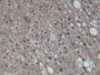 DAB staining on IHC-P; Samples: Human Liver Tissue;  Primary Ab: 20µg/ml Mouse Anti-Human CYP3A7 Ant