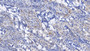 DAB staining on IHC-P; Samples: Human Small intestine Tissue; Primary Ab: 20µg/ml Rabbit Anti-Human GS Antibody Second Ab: 2µg/mL HRP-Linked Caprine Anti-Rabbit IgG Polyclonal Antibody
