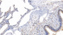 DAB staining on IHC-P; Samples: Human Lung Tissue; Primary Ab: 20µg/ml Rabbit Anti-Human STAT1 Antibody Second Ab: 2µg/mL HRP-Linked Caprine Anti-Rabbit IgG Polyclonal Antibody
