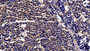 DAB staining on IHC-P; Sample: Human Lymph node Tissue; Primary Ab: 20μg/ml Rabbit Anti-Human STAT1 Antibody Second Ab: 2µg/mL HRP-Linked Caprine Anti-Rabbit IgG Polyclonal Antibody