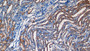 DAB staining on IHC-P; Samples: Rat Kidney Tissue;  Primary Ab: 10µg/ml Rabbit Anti-Rat KL Antibody Second Ab: 2µg/mL HRP-Linked Caprine Anti-Rabbit IgG Polyclonal Antibody 