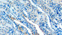 DAB staining on IHC-P; Samples: Rat Kidney Tissue;  Primary Ab: 10µg/ml Rabbit Anti-Rat SDC1 Antibody Second Ab: 2µg/mL HRP-Linked Caprine Anti-Rabbit IgG Polyclonal Antibody 