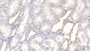 DAB staining on IHC-P; Samples: Human Kidney Tissue;  Primary Ab: 10µg/ml Mouse Anti-Human GS Antibody Second Ab: 2µg/mL HRP-Linked Caprine Anti-Mouse IgG Polyclonal Antibody 