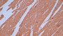 DAB staining on IHC-P; Samples: Human Cerebrum Tissue;  Primary Ab: 10µg/ml Mouse Anti-Human MBP Antibody Second Ab: 2µg/mL HRP-Linked Caprine Anti-Mouse IgG Polyclonal Antibody 