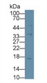 Procalcitonin (PCT) Monoclonal Antibody, CAU30191