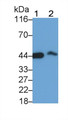 Creatine Kinase, Muscle (CKM) Monoclonal Antibody, CAU30221