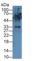 Tumor Necrosis Factor Alpha (TNFa) Monoclonal Antibody, CAU30252