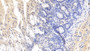DAB staining on IHC-P; Samples: Bovine Colon Tissue; Primary Ab: 10µg/ml Mouse Anti-Bovine TNFa Antibody Second Ab: 2µg/mL HRP-Linked Caprine Anti-Mouse IgG Polyclonal Antibody