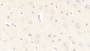DAB staining on IHC-P; Samples: Human Cerebrum Tissue; Primary Ab: 20μg/ml Rabbit Anti-Human FABP2 Antibody Second Ab: 2µg/mL HRP-Linked Caprine Anti-Rabbit IgG Polyclonal Antibody