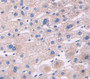 Insulin Like Growth Factor Binding Protein 3 (IGFBP3) Polyclonal Antibody, Cat#CAU30259