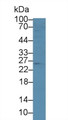 Orosomucoid 2 (ORM2) Polyclonal Antibody, CAU30267