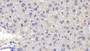 DAB staining on IHC-P; Samples: Mouse Liver Tissue; Primary Ab: 20μg/ml Rabbit Anti-Mouse TNFa Antibody Second Ab: 2µg/mL HRP-Linked Caprine Anti-Rabbit IgG Polyclonal Antibody