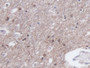 DAB staining on IHC-P; Samples: Human Cerebrum Tissue;  Primary Ab: 20µg/ml Mouse Anti-Human CKM Antibody Second Ab: 2µg/mL HRP-Linked Caprine Anti-Mouse IgG Polyclonal Antibody 
