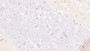 DAB staining on IHC-P; Samples: Human Cerebrum Tissue; Primary Ab: 10µg/ml Mouse Anti-Human ZPI Antibody Second Ab: 2µg/mL HRP-Linked Caprine Anti-Mouse IgG Polyclonal Antibody