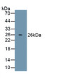 Orosomucoid 2 (ORM2) Monoclonal Antibody, CAU30343