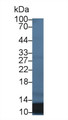 S100 Calcium Binding Protein A12 (S100A12) Monoclonal Antibody, CAU30345