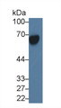 Alpha-Fetoprotein (AFP) Monoclonal Antibody, CAU30348