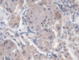 DAB staining on IHC-P; Samples: Human Stomach Tissue; Primary Ab: 20µg/ml Mouse Anti-Human EGR1 Antibody Second Ab: 2µg/mL HRP-Linked Caprine Anti-Mouse IgG Polyclonal Antibody