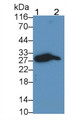 Programmed Cell Death Protein 1 (PD1) Monoclonal Antibody, CAU30366