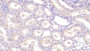 DAB staining on IHC-P; Samples: Human Kidney Tissue; Primary Ab: 40µg/ml Mouse Anti-Human NT3 Antibody Second Ab: 2µg/mL HRP-Linked Caprine Anti-Mouse IgG Polyclonal Antibody