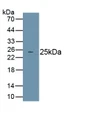 Receptor I For The Fc Region Of Immunoglobulin E (FceRI) Polyclonal Antibody, CAU30395