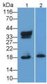 Ribonuclease A2 (RNASE2) Monoclonal Antibody, CAU30402