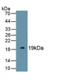 Western Blot; Sample: Recombinant PROCR, Rat.