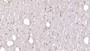 DAB staining on IHC-P; Samples: Human Cerebellum Tissue; Primary Ab: 20µg/ml Mouse Anti-Human DCLK1 Antibody Second Ab: 2µg/mL HRP-Linked Caprine Anti-Mouse IgG Polyclonal Antibody