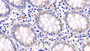 DAB staining on IHC-P; Sample: Human Colon Tissue; Primary Ab: 20μg/ml Mouse Anti-Human ERK1 Antibody Second Ab: 2µg/mL HRP-Linked Caprine Anti-Mouse IgG Polyclonal Antibody