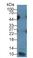 Interleukin 7 (IL7) Monoclonal Antibody, CAU30420