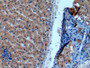DAB staining on IHC-P; Samples: Human Liver Tissue;  Primary Ab: 10µg/ml Mouse Anti-Human NOS2 Antibody Second Ab: 2µg/mL HRP-Linked Caprine Anti-Mouse IgG Polyclonal Antibody 
