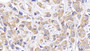 DAB staining on IHC-P; Samples: Human Spleen Tissue;  Primary Ab: 20µg/ml Mouse Anti-Human Bcl2 Antibody Second Ab: 2µg/mL HRP-Linked Caprine Anti-Mouse IgG Polyclonal Antibody 