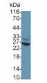Tumor Necrosis Factor Alpha (TNFa) Monoclonal Antibody, CAU30474