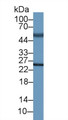 Adrenocorticotropic Hormone (ACTH) Monoclonal Antibody, CAU30506