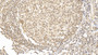 DAB staining on IHC-P; Samples: Human Tonsil Tissue; Primary Ab: 10µg/ml Mouse Anti-Human FOXP3 Antibody Second Ab: 2µg/mL HRP-Linked Caprine Anti-Mouse IgG Polyclonal Antibody DAB staining on IHC-P; Samples: Human Tonsil Tissue; Primary Ab: 10µg/ml Mouse Anti-Human FOXP3 Antibody Second Ab: 2µg/mL HRP-Linked Caprine Anti-Mouse IgG Polyclonal Antibody