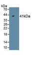 Creatine Kinase, Muscle (CKM) Monoclonal Antibody, CAU30539