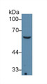 Collagen Type VIII Alpha 1 (COL8a1) Monoclonal Antibody, CAU30558
