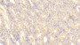 DAB staining on IHC-P; Samples: Human Kidney Tissue; Primary Ab: 30μg/ml Mouse Anti-Human LIF Antibody Second Ab: 2µg/mL HRP-Linked Caprine Anti-Mouse IgG Polyclonal Antibody