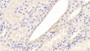 FITC staining on IF; Samples: Human HepG2 cell;  Primary Ab: 20μg/ml Mouse Anti-Human a2PI Antibody Second Ab: 1μg/ml FITC-Linked Caprine Anti-Mouse IgG Polyclonal Antibody 