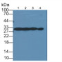 Galectin 3 (GAL3) Monoclonal Antibody, CAU30617
