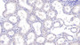 DAB staining on IHC-P; Samples: Human Kidney Tissue;  Primary Ab: 40µg/ml Mouse Anti-Human aHSP Antibody Second Ab: 2µg/mL HRP-Linked Caprine Anti-Mouse IgG Polyclonal Antibody 