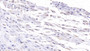 DAB staining on IHC-P; Samples: Human Placenta Tissue;  Primary Ab: 10µg/ml Mouse Anti-Human DSG3 Antibody Second Ab: 2µg/mL HRP-Linked Caprine Anti-Mouse IgG Polyclonal Antibody 