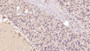DAB staining on IHC-P; Samples: Human Cerebellum Tissue; Primary Ab: 40µg/ml Mouse Anti-Human PTHR2 Antibody Second Ab: 2µg/mL HRP-Linked Caprine Anti-Mouse IgG Polyclonal Antibody