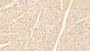 DAB staining on IHC-P; Samples: Human Cardiac Muscle Tissue; Primary Ab: 30µg/ml Mouse Anti-Human NT-ProBNP Antibody Second Ab: 2µg/mL HRP-Linked Caprine Anti-Mouse IgG Polyclonal Antibody