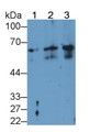 Keratin 2 (CK2) Monoclonal Antibody, CAU30636 Keratin 2 (CK2) Monoclonal Antibody, CAU30636