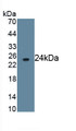 Fc Fragment Of IgG Low Affinity IIIb Receptor (FcgR3B) Monoclonal Antibody, CAU30715