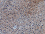DAB staining on IHC-P; Samples: Human Liver Tissue;  Primary Ab: 10µg/ml Mouse Anti-Human CTACK Antibody Second Ab: 2µg/mL HRP-Linked Caprine Anti-Mouse IgG Polyclonal Antibody 