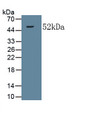 Collagen Type V Alpha 2 (COL5a2) Monoclonal Antibody, CAU30776
