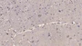 DAB staining on IHC-P; Samples: Human Cerebrum Tissue; Primary Ab: 10µg/ml Mouse Anti-Human RL Antibody Second Ab: 2µg/mL HRP-Linked Caprine Anti-Mouse IgG Polyclonal Antibody